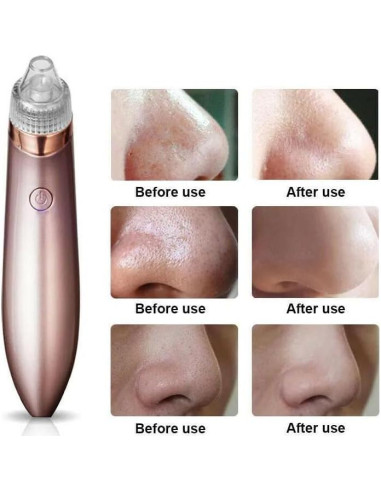 Aspiradora Eléctrica de Puntos Negros ZENARA AS23DT6 - Limpieza Profunda