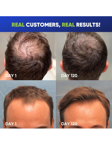 Champú Engrosante para Hombres Svvimer 400 ml - Biotina y Romero