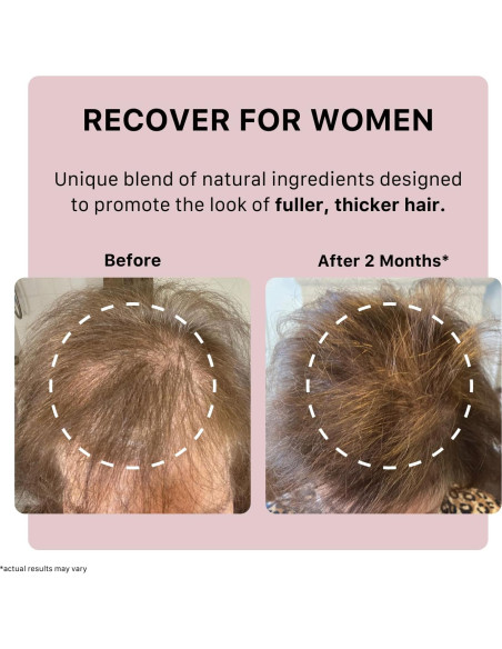 Champú Engrosante ACTIIV para Mujeres 79.83 ml - Vegano