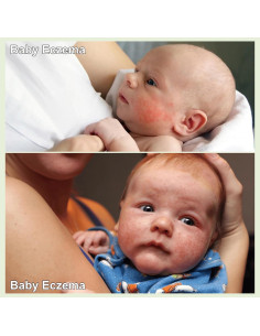 Crema para Bebés Cuidado Erupciones Calor 100ml - Senmai 2