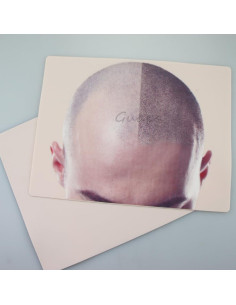 Piel de Práctica Micropigmentación Cuero Cabelludo MARLLOGIVA 19x14.5cm 2