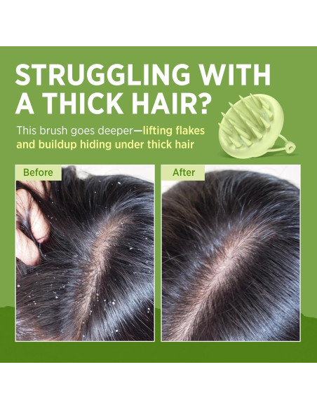 Cepillo Masajeador de Cuero Cabelludo Roycederm - Silicona Suave Cepillo Masajeador de Cuero Cabelludo Roycederm - Silicona Suave