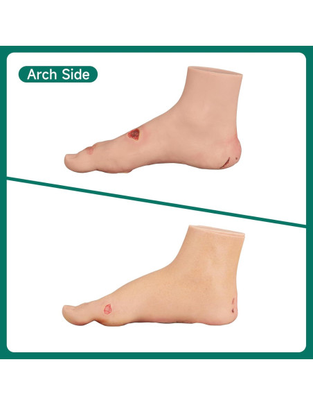 Conjunto de Ulcera del Pie Diabético Ultrassist - Modelo Clínico
