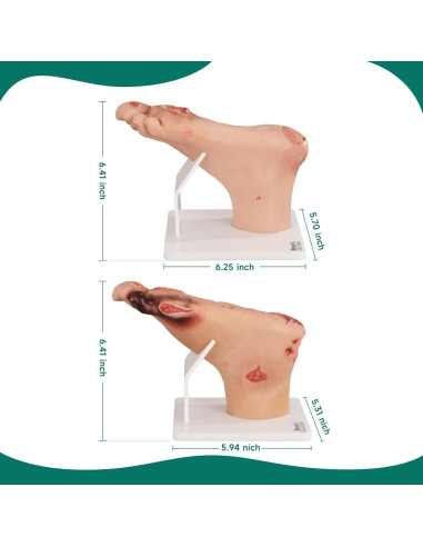 Conjunto de Ulcera del Pie Diabético Ultrassist - Modelo Clínico