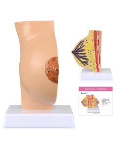 Modelo Anatómico de Mama No Lactante Ultrassist con Tarjeta de Estudio