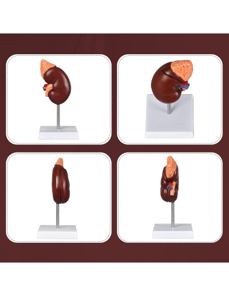 Modelo de Anatomía del Riñón Desmontable Simedutech 1:1 PVC