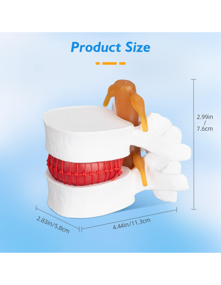 Modelo Anatómico de Herniación de Disco Lumbar 1.5X