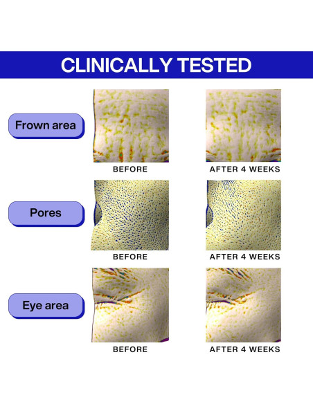 Suero Antienvejecimiento IOPE PDRN con Cafeína y Retinol 30ml