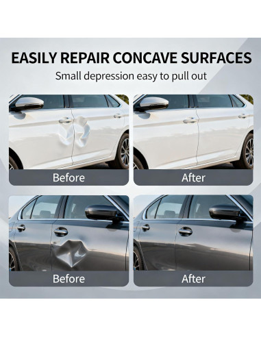 Kit de Reparación de Abolladuras PWOOTEIY 3 Piezas 2025
