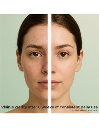 Gel Limpiador Exfoliante Vegano Insane Glow - 200ml - Ácido Hialurónico