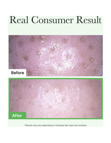 Aceite Limpiador Desmaquillante ARENCIA Pore Melt 200 ml