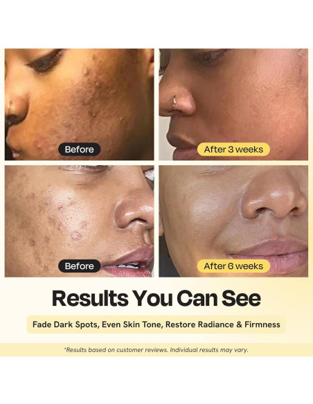 Suero Facial Iluminador Gleamin 15% Vitamina C 29.57 ml