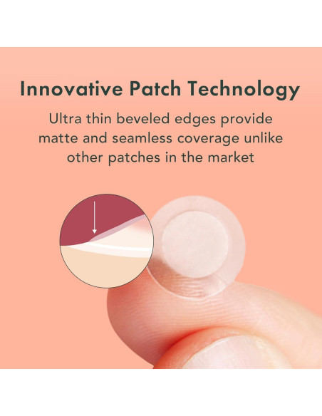 Rael Korea Cuidado de la Piel - Parche para Granitos 96 Unidades