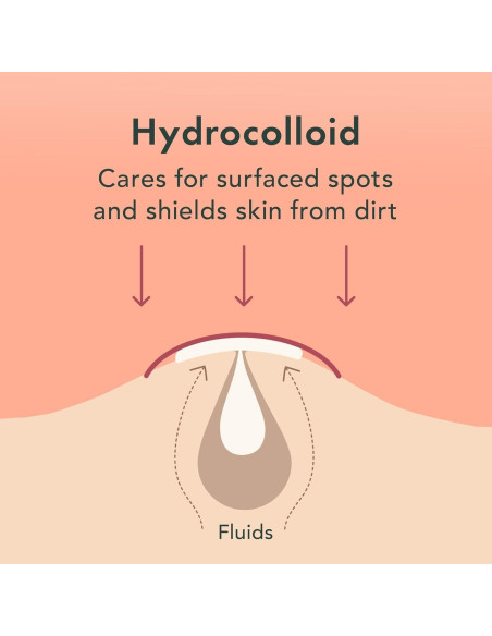 Rael Korea Cuidado de la Piel - Parche para Granitos 96 Unidades
