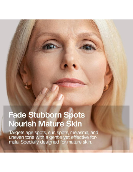 Crema Aclaradora Jtopyrt para Manchas Oscuras 181g