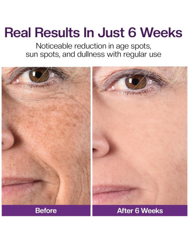 Crema Aclaradora Jtopyrt para Manchas Oscuras 181g