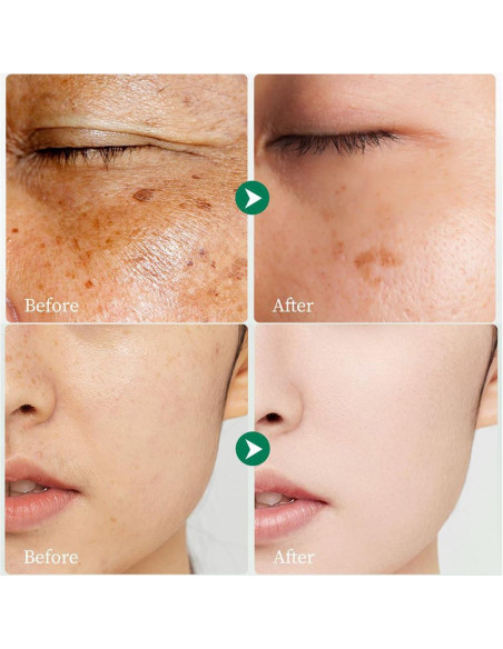 Crema Removedora de Manchas Oscuras Paminify 48g - Vitamina C