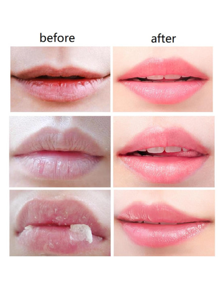 Bálsamo Labial de Miel 4 PCS WenFeng Hidratante 181g