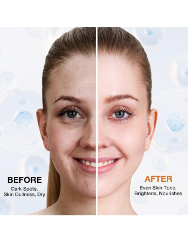 Removedor de Manchas Oscuras Ausmtal 19.9 ml con Rodillo Masaje