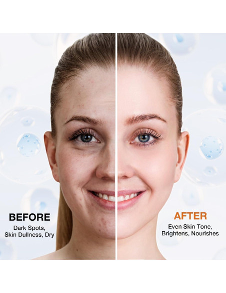 Removedor de Manchas Oscuras Ausmtal 19.9 ml con Rodillo Masaje