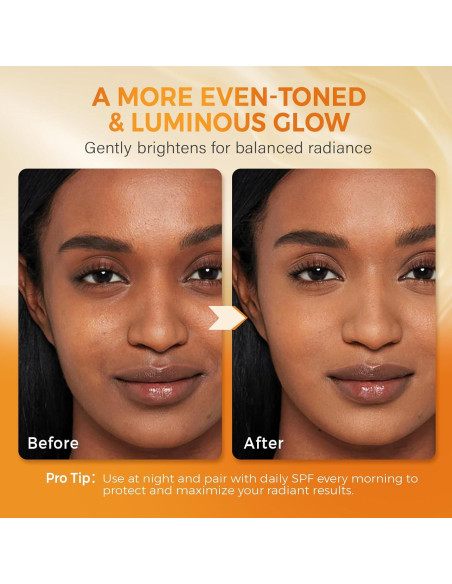 Jabón Aclarador QOOQ con Ácido Kójico y Cúrcuma 480g