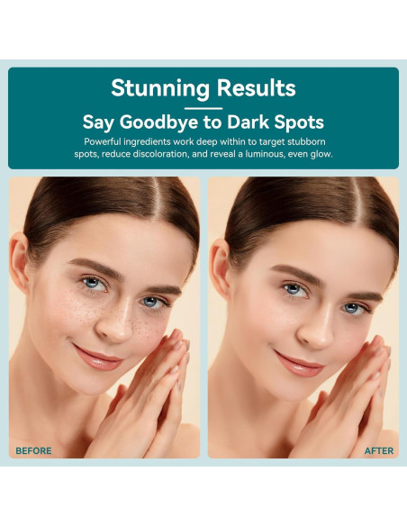 Removedor de Manchas Oscuras UFEEK con Bola de Masaje 360