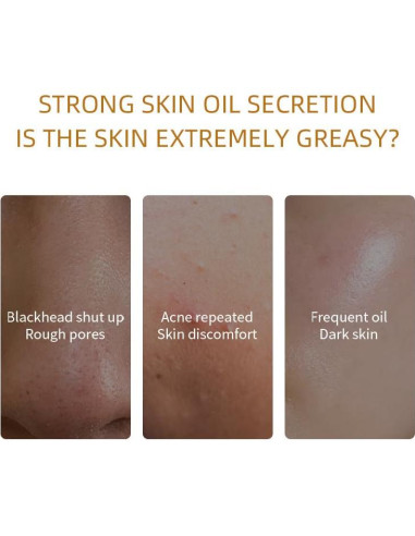 Kit de Mascarilla de Arcilla Orgánica ALPAIS - 10 Cápsulas