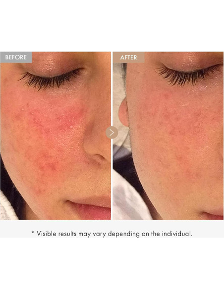 Crema de Alivio de Avena Real TOSOWOONG 50ml Hidratante Facial