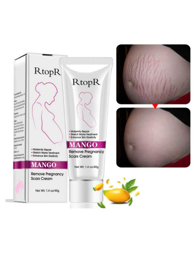 Crema Hidratante para Estrías y Cicatrices YG LianKai 40g