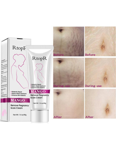 Crema Hidratante para Estrías y Cicatrices YG LianKai 40g