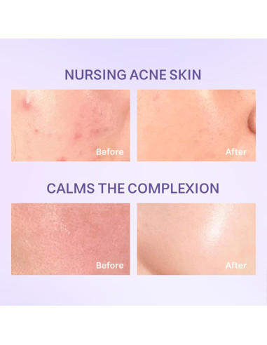 Limpiador Facial Suave HWM 93g con Ceramidas y Arándano