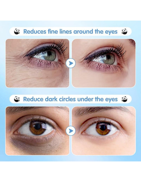 Parche Hidratante para Ojos Epstur - 60 Pares con Ácido Hialurónico