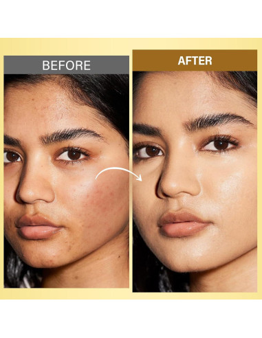 Aceite Facial Antienvejecimiento RIHAKO Cúrcuma y Rosa Mosqueta 181g