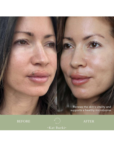 Suero Facial Enzimático Kat Burki pH+ 100 ml Equilibrante