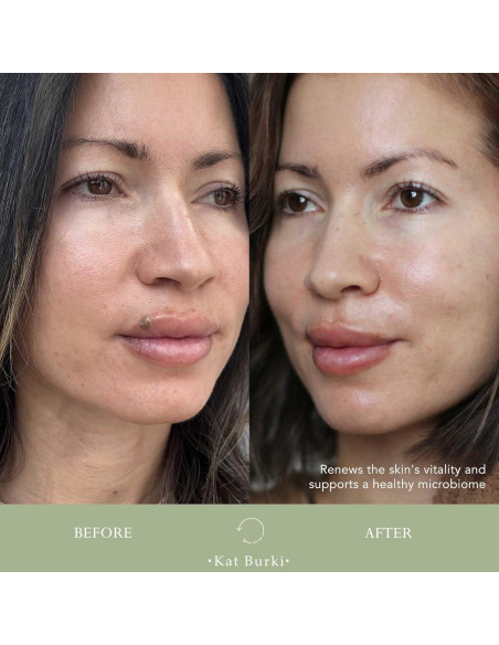 Suero Facial Enzimático Kat Burki pH+ 100 ml Equilibrante