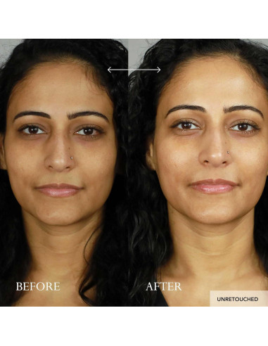 Suero Facial Enzimático Kat Burki pH+ 100 ml Equilibrante