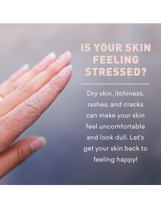 Loción Calmante Just Nutritive 453 g para Piel Seca y Eccema 2