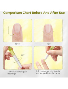 Aceite para Crecimiento de Uñas Nailz GIL - 4 PZS 2