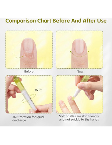 Aceite para Crecimiento de Uñas Nailz GIL - 4 PZS