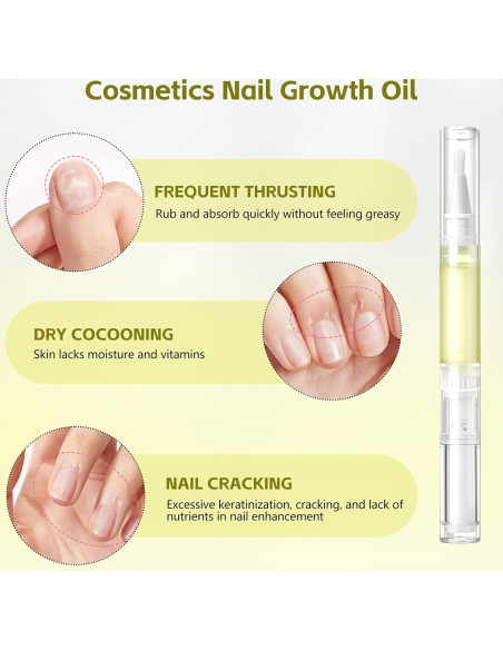 Aceite para Crecimiento de Uñas Nailz GIL - 4 PZS