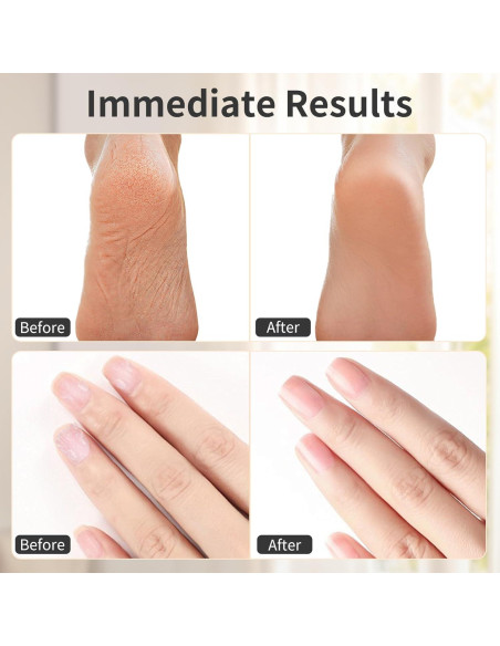 Removedor de Callos Eléctrico FyndAna 2 en 1 Inalámbrico 6 Velocidades