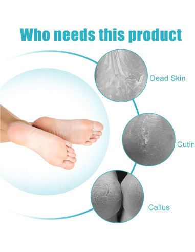 Removedor de Callos 4 en 1 Yclin - Lima de Pies Gris
