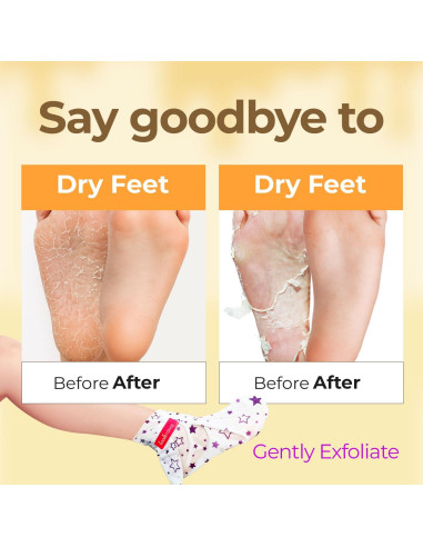 Máscara Exfoliante para Pies KSBC con Miel y Aceite de Coco