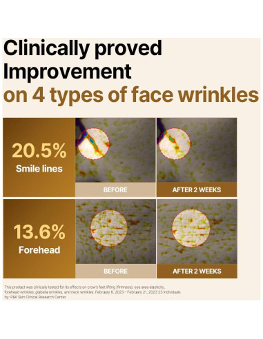 Stick Ampoule Elevación Intensiva ISOI 15ml - Cuidado Piel Coreano