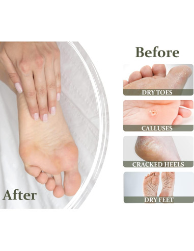 Crema para Pies Secos y Agrietados Vollare 100g - Urea y Aceite de Oliva