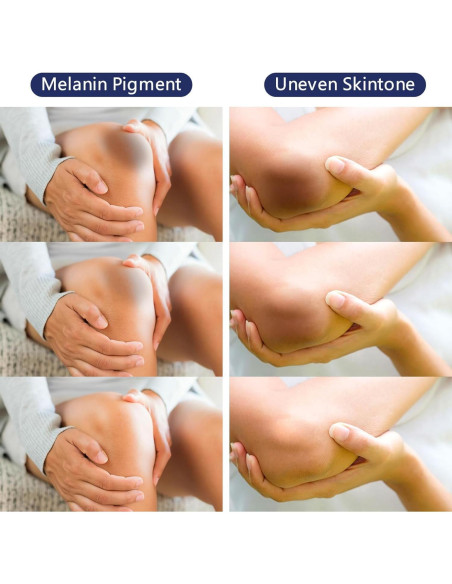 Crema Aclarante para Áreas Íntimas Gukei 91g - Blanqueadora