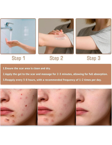 Barra de Silicona para Cicatrices Prequel Skin 60% 140g