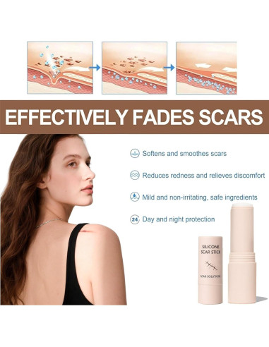 Barra de Silicona para Cicatrices Prequel Skin 60% 140g