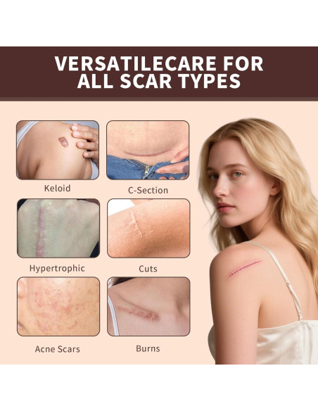 Barra de Silicona para Cicatrices Prequel Skin 60% 140g