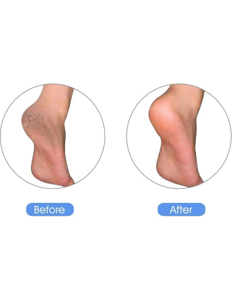 Piedra Pómez Natural KuuCare para Pies - Exfoliante 9.9cm